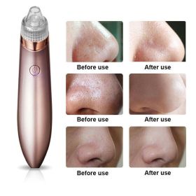 Electric Blackhead Vacuum Pore Cleaner Acne Pimple Remover Strong Suction Tool Electric Blackhead Remover Pore Vacuum Suction Diamond Dermabrasio